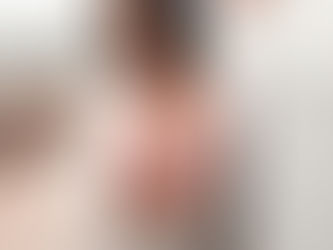 Före och efter bröstlyft: Dr. Virginia Gonzalez förklarar realistiska resultat och läkning