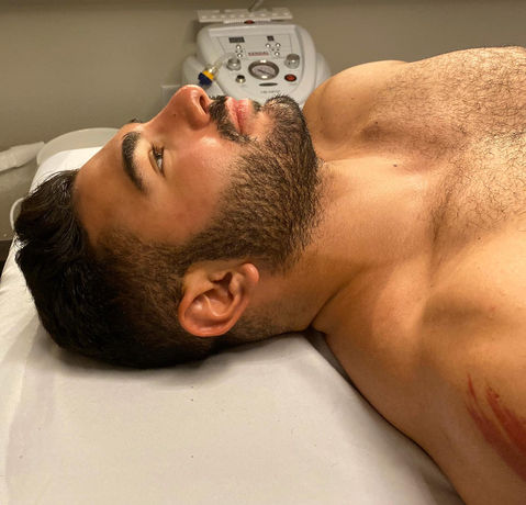 24k Gold facial Idan Med Spa