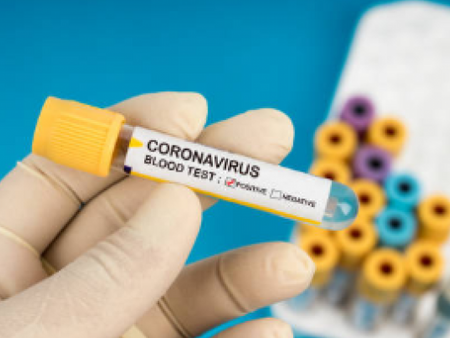 Coronavirus en RDC : 152 nouveaux cas confirmés mercredi