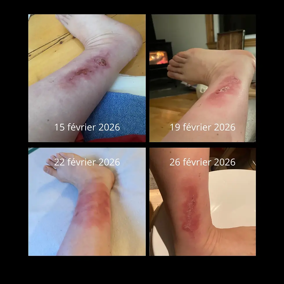 Image de Douleurs chroniques, migraines et symptômes divers, médecine vibratoire