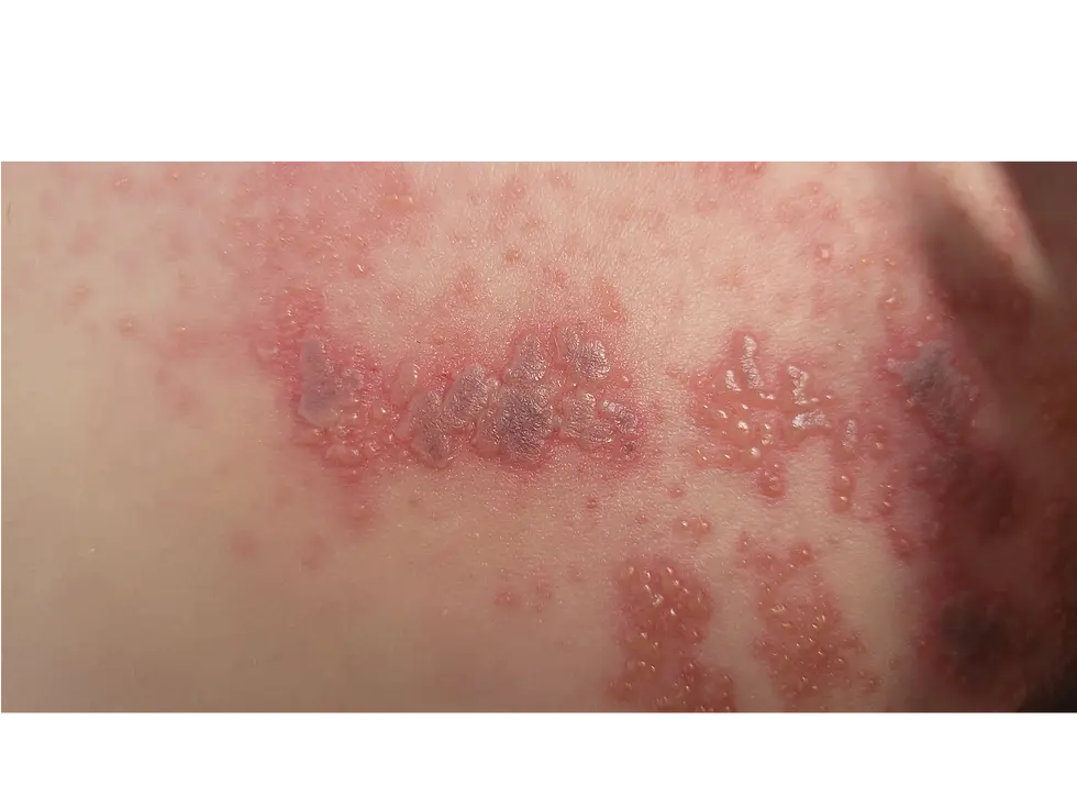 Image de Douleurs chroniques, migraines et symptômes divers, médecine vibratoire