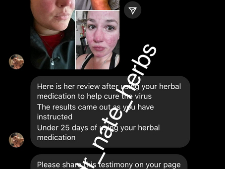 Herpes permanent cured