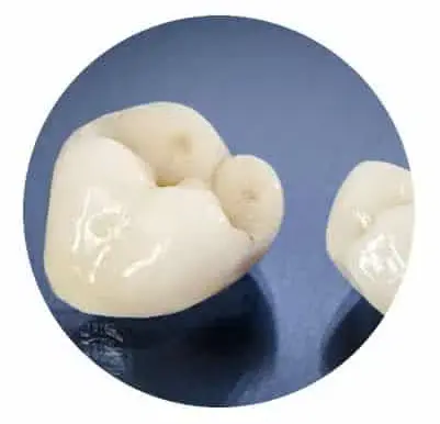 DENTAL CROWN MANUFACTURING – THE 3 W’S