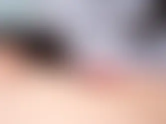 Como a Eletroacupuntura Acelera a Recuperação de Idosos com Dor Crônica nas Costas