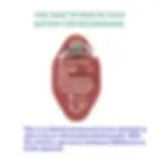 Thumbnail: Rebuild service for Synthes 532.003 Battery Rebuild Service