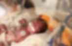 28 weeks premature