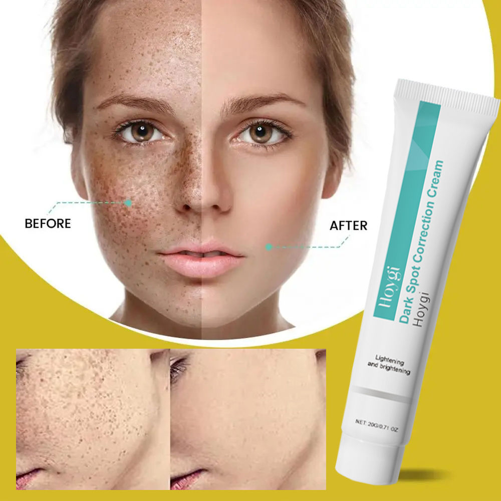 Powerful Spot-removing Brightening Cream Brighten Fast Melanin