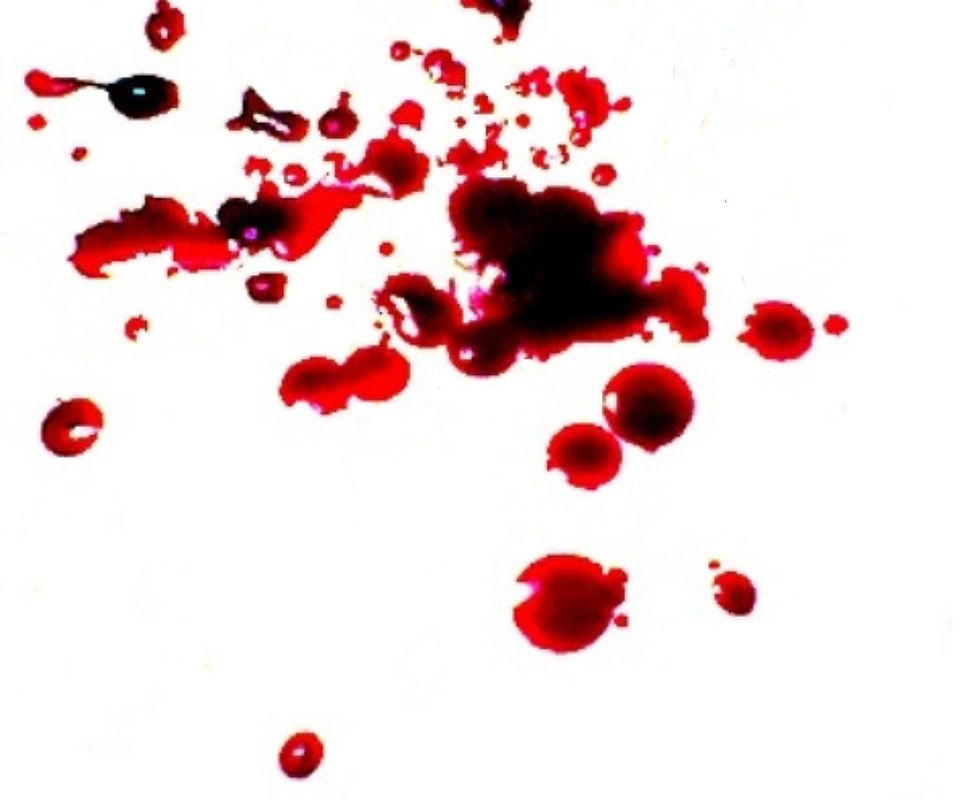Blood droplets
