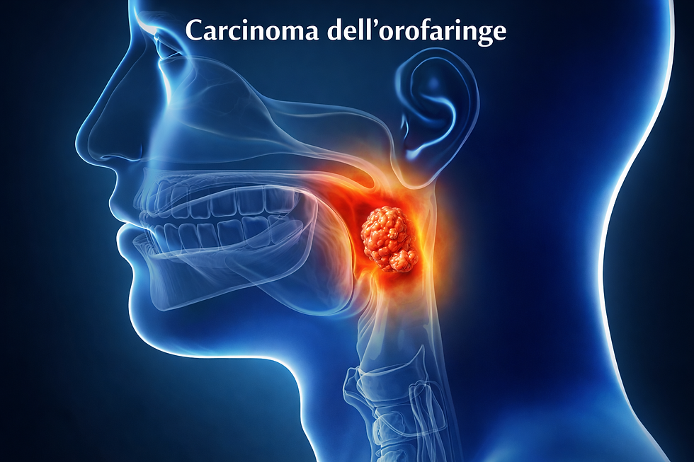 Carcinoma dell'orofaringe