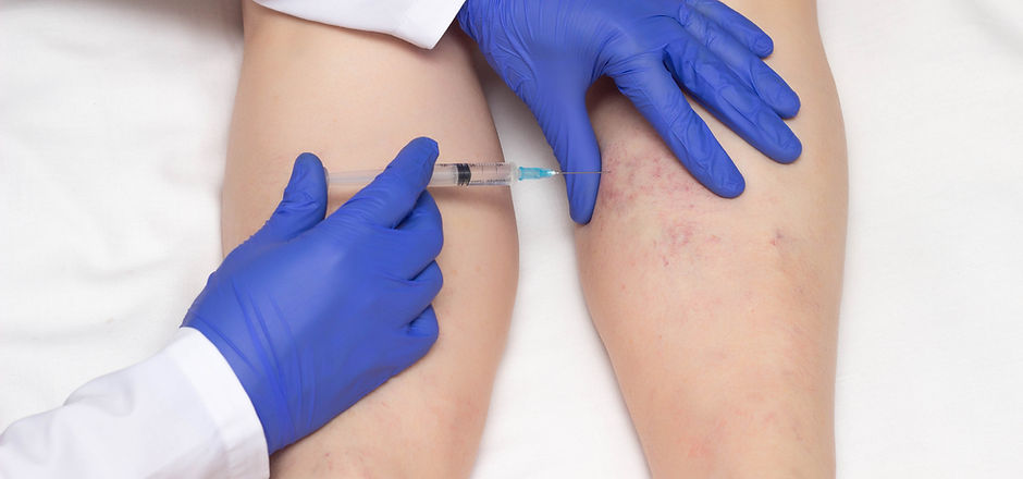 Doctor in medical gloves injects sclerotherapy procedure on the legs of a woman against va