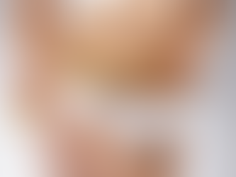 The Dramatic Increase in Obesity Worldwide