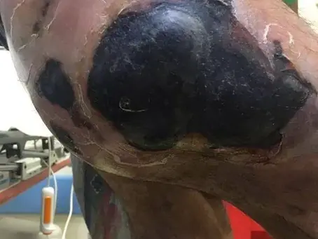 This is why you should NOT use drugs!