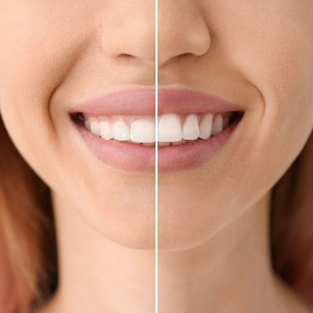 I need a Cosmetic Dentist