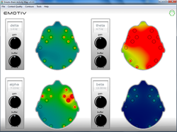 Brain_activity_1