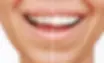 Cosmetic Dentistry.webp