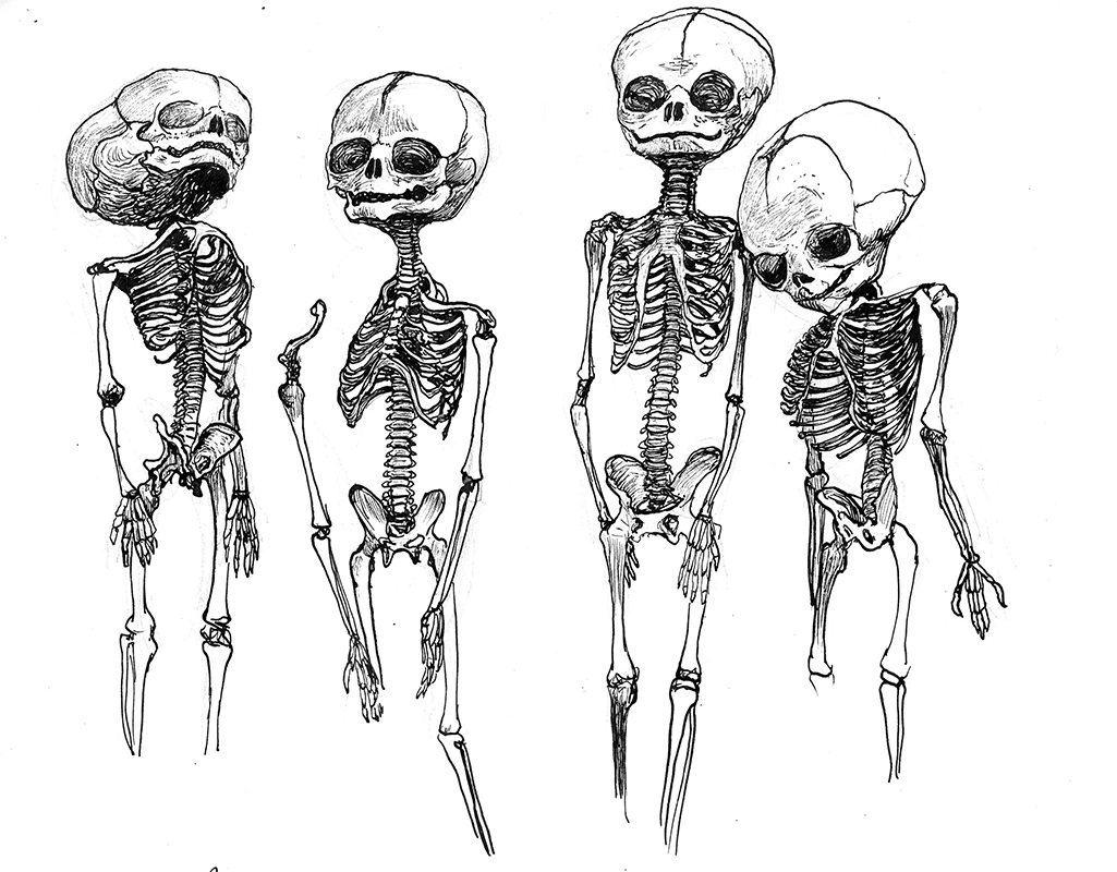 Skeleton-club