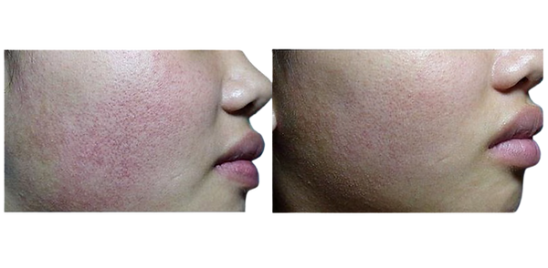 Before & After 2.png