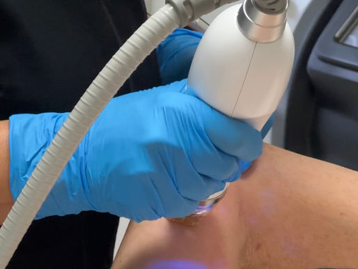 Smoother Skin, Fewer Stretch Marks