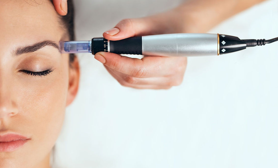 Microneedling