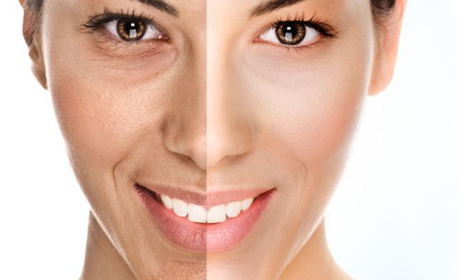 Oxygeneo 3-in-1 Super Facial