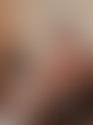 NÅR KROPPEN IKKE VIL FINDE SIG TIL RETTE