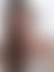 FEM TRIN TIL ET HVIDERE SMIL