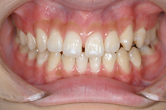 569水川 杏_20250107172640_7668.png