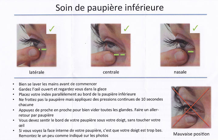 soins des paupières, oeil sec
