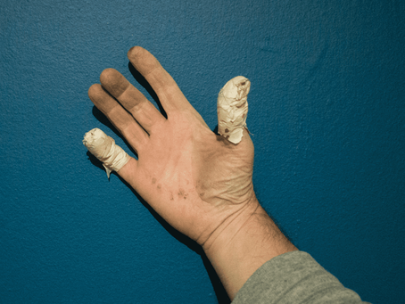 Top 10 Workers' Compensation Injuries