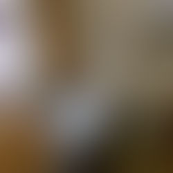 腹腔鏡下子宮筋腫摘出手術の記録③~手術・入院編~