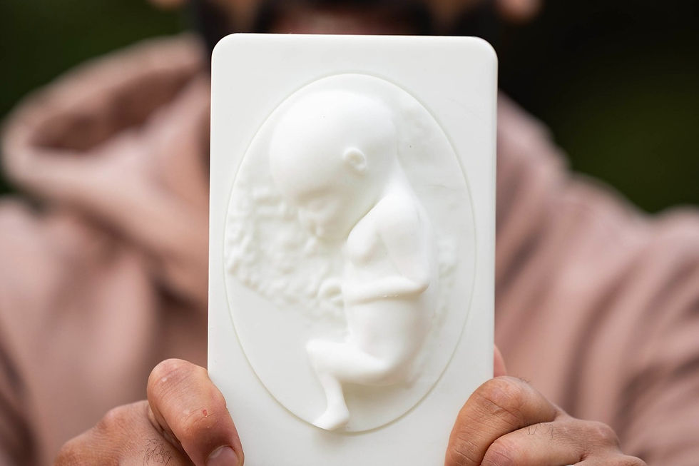 Hands hold a white 3D scan of an ultrasound, with a blurred person in pink behind it.