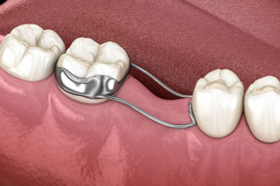 Screenshot 2026-04-15 141718.png