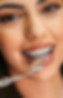 how-much-are-braces-uk.jpg
