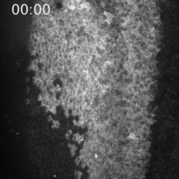 カルシウムイオンに駆動される脳の形づくりのメカニズム