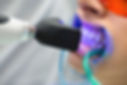 laser-tooth-whitening.jpeg