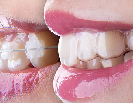 ortho.jpeg