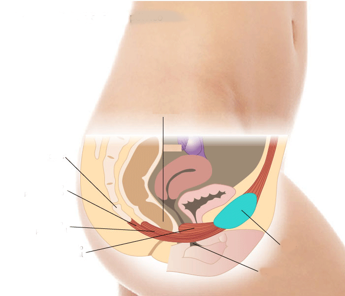 Fallo musculatura suelo pelvico | prolapso