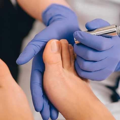 What Else Needs to Happen Other Than the Laser Session for Fungal Nail Treatment?