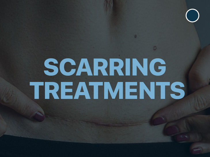 Scarring Treatments