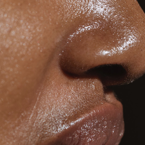 A picture of Oily skin. 