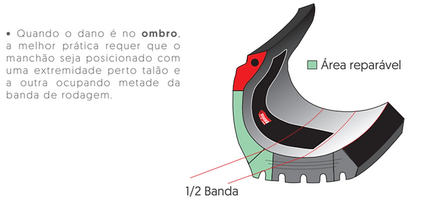 Posicionamento Correto Ombro.png