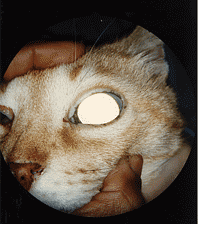 GlaucomaImage.gif