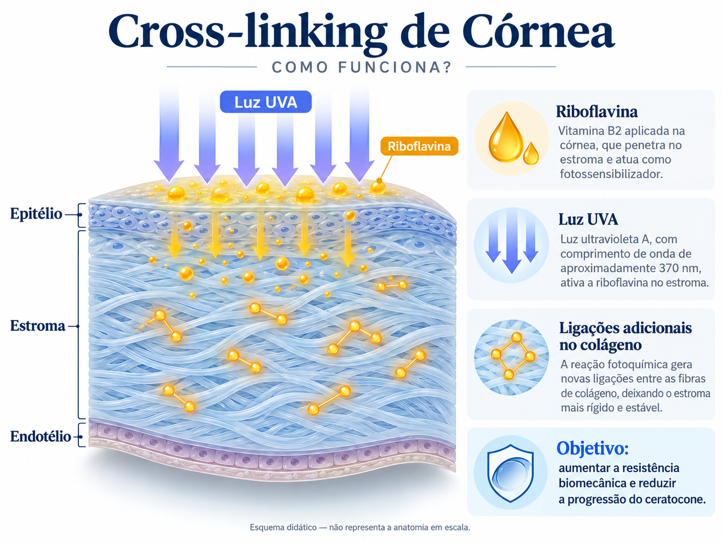 Infográfico do crosslinking corneano: epitélio, estroma, riboflavina, luz UVA e ligações adicionais entre fibras de colágeno