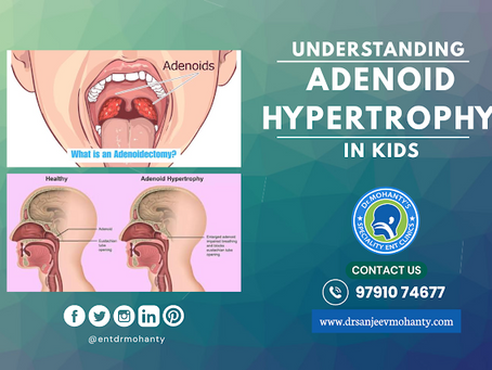 Adenoid Hypertrophy in Children: Symptoms, Diagnosis & When to Consider Surgery