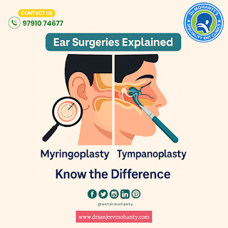 How to Choose Between Tympanoplasty and Myringoplasty: A Complete Patient Guide