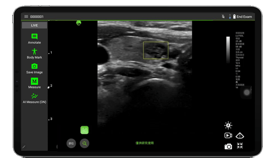diagnostico automatico de tiroides