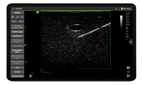 Ecografo con mejora de la aguja
