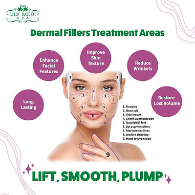 Dermal Fillers