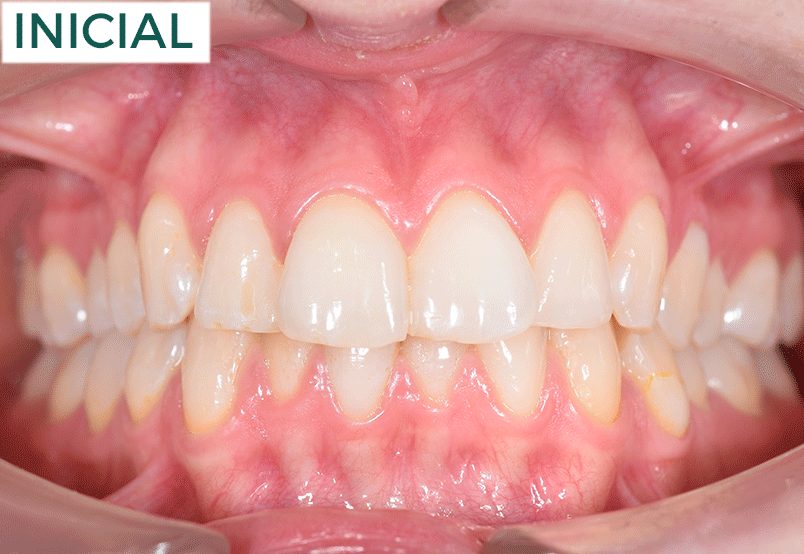 SAMIA-FRENTE-MODERADA-COMPLEJ-UNA-FOTO.g