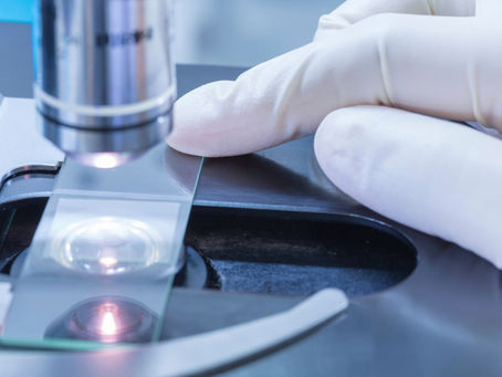 Azoospermia Treatment 